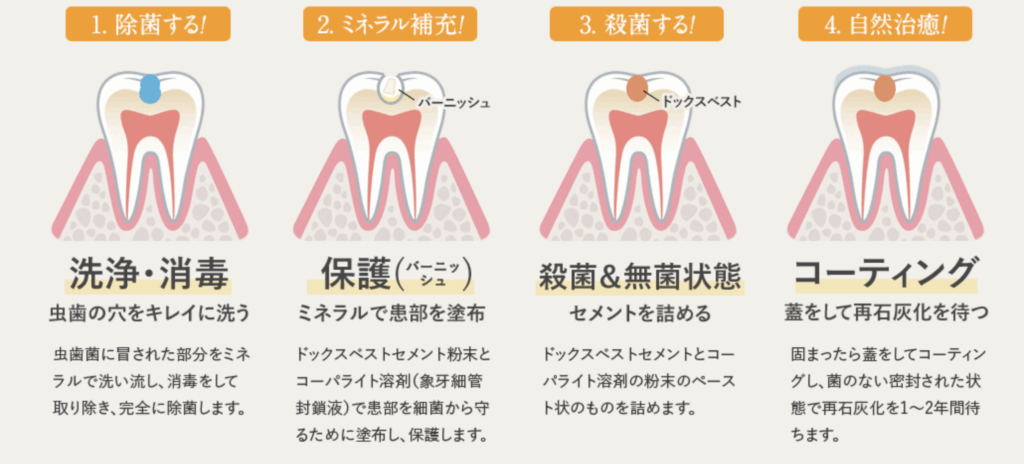 ドックスベストセメントによる治療｜かながわ歯科