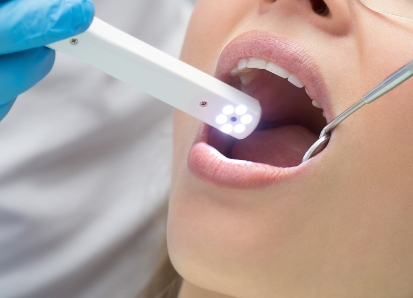 臭の原因を見極める専門的な診断|かながわ歯科