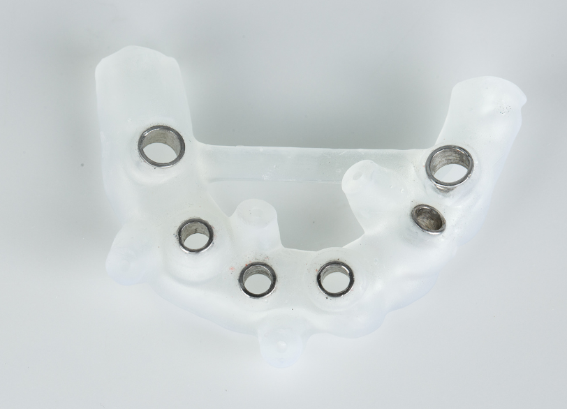 サージカルガイド|かながわ歯科