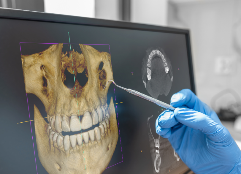 精密な診断機器の活用｜かながわ歯科