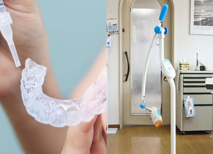 デュアルホワイトニング｜かながわ歯科